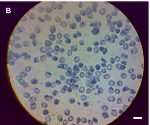 bakteri-dalam-darah-dengan-cellscope-hp